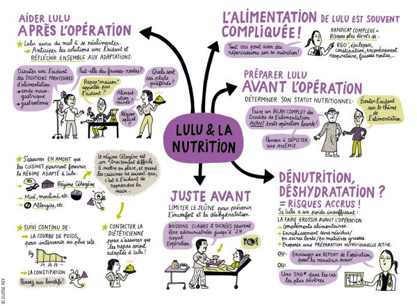 Carte mentale sur la nutrition : avant et après l’opération, risques de dénutrition et de déshydratation.